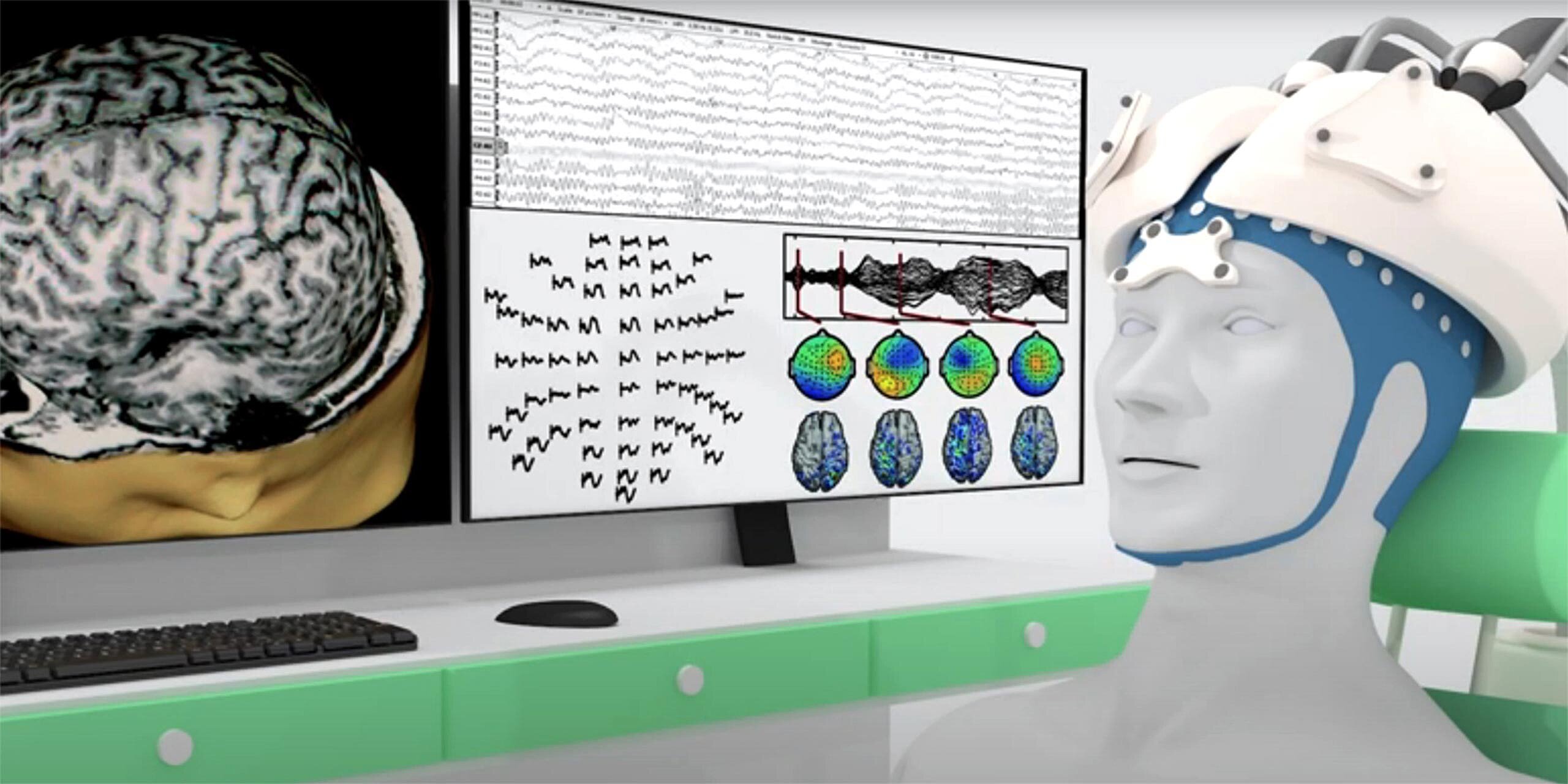 Medizinische Innovation: per Helm gegen Schlaganfälle?